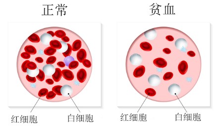 全基因测序FLNA基因检测有意义未明突变，我该怎么办？